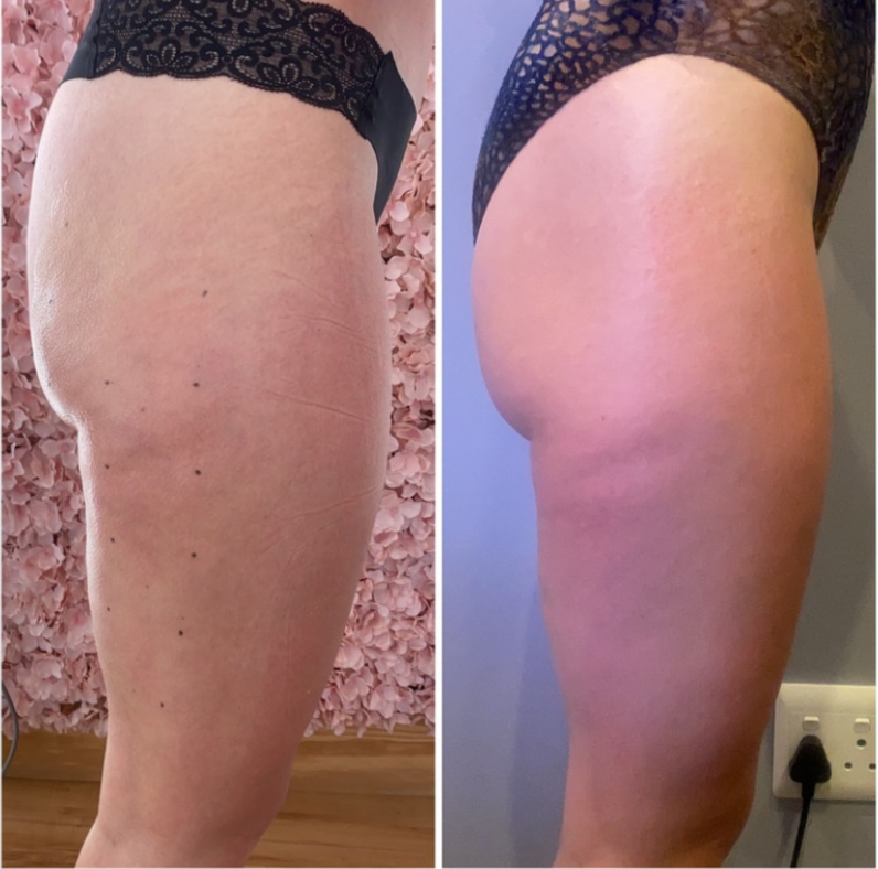 Understanding Peptides: The Building Blocks of BioInnovation